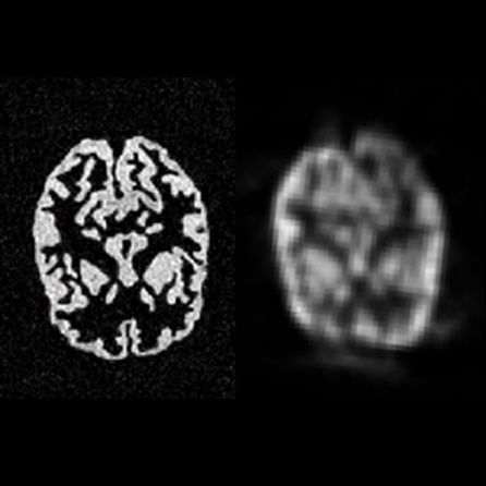 Simultaneous MRI and PET imaging
