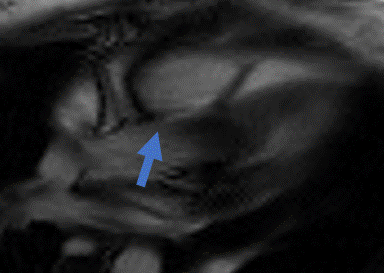 MRI motion correction visualization