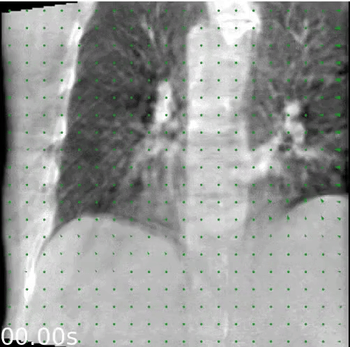 CBCT motion correction visualization