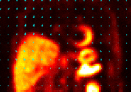 PET motion correction visualization